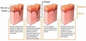 احیا کردن، بازسازی و تحریک کلاژن سازی پوست از طریق نخ قابل جذب pdo